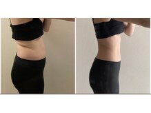 ヨサパーク ルルド(YOSA PARK Lulu′d)の雰囲気（ルルオンで痩せ体質ゲットすればお腹もへこむ◎）