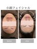小顔フェイシャル+ヘッドマッサージ