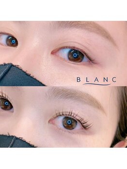 アイラッシュサロン ブラン 名西店(Blanc)/マツパ☆ビフォー→アフター