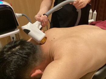 ミルキー(MiLuKy)/メンズ脱毛