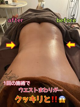 ルミネ(Lumine)/気になるお腹周りに強い味方です