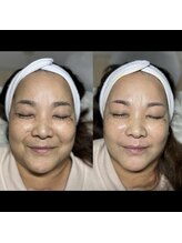 ムギムギ(mugi mugi)/艶肌wax&VOSパック