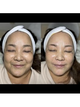 ムギムギ(mugi mugi)/艶肌wax&VOSパック