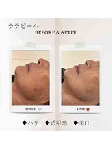 エクラ アン(eclat.un)/40代女性：ララピール