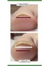 【Foot 巻き爪ケア】※2回目から
