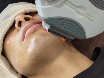 アンジェリーナの写真/脱毛はスキンケアの第一歩！肌をキレイにしたいなら【ヒゲ脱毛】初回半額1回￥4000都度払いでトライアル