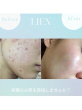 リアン(LIEN)/あなたも変わりませんか？