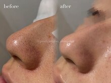 ポアレスラボ 新宿マルイ本館店/お客様ビフォーアフター