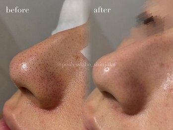 ポアレスラボ 新宿マルイ本館店/お客様ビフォーアフター