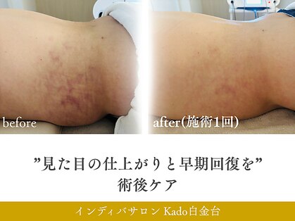 カド 白金台(Kado)の写真