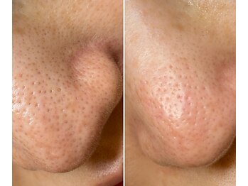 サイ(Sai)/before⇒after