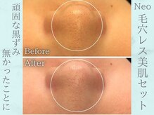 ネオファースト(NeoFirst)の雰囲気（フォトギャラリーにビフォーアフター掲載してます♪ご覧ください）