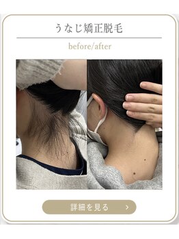 ミース 上野店/うなじデザインの実例