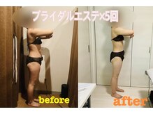 ブルーム(Bloom)/ブライダルエステのお客様