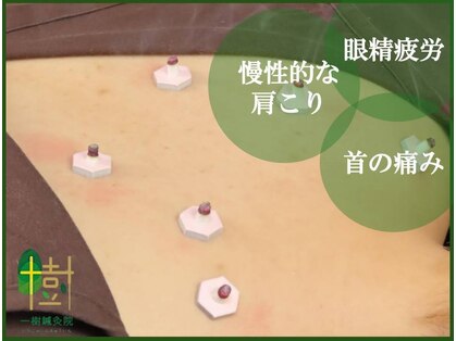 一樹鍼灸院の写真