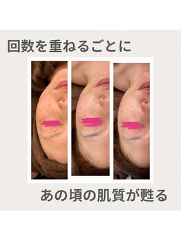 ヴィヴ コレビ(VIV COREBI)/最強のエイジングケア♪