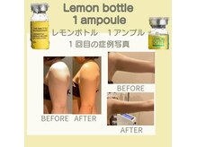 ビボウ(Bibou)の雰囲気（二の腕！韓国美容レモンボトル脂肪分解）
