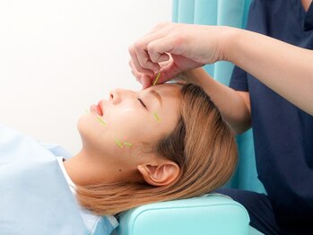 すかい鍼灸整体院の写真/【美容鍼で目周り&頭皮にアプローチ!】蓄積した眼精疲労は深部から働きかけ根本から解消!肩こり/頭痛に◎