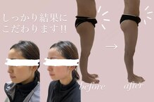 ヨサパーク グリーン(YOSA PARK 緑 green)