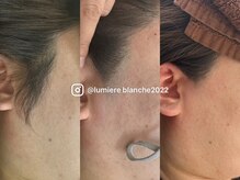 ルミエールブランシュ(Lumiere blanche)の雰囲気（通われてからもご相談ください★）