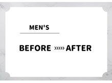 アルゴ 福津店(ALGO)/【メンズ脱毛】ビフォーアフター