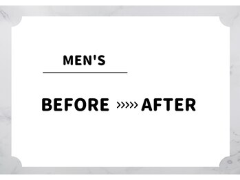 アルゴ 福津店(ALGO)/【メンズ脱毛】ビフォーアフター