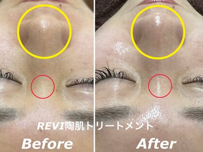 グリズコルギ(Guri's korugi)の写真