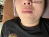男性、初めての髭脱毛お試しキャンペーン¥1500引き!