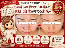 ユウビジン(YOU美人)