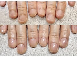 ケアのみで育成