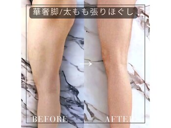 ラグラン銀座メディカルエステ 高輪ゲートウェイ店/華奢脚/太もも張りほぐし
