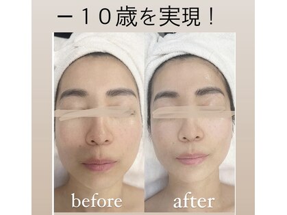 ビューティーアカデミーの写真