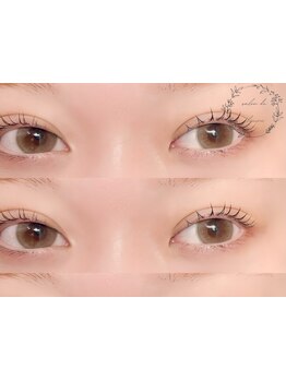 まつげのお悩み解決サロン