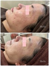 ビエル(Bielle)/季節の変わり目にゆらぎやすい肌