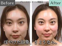 グレースフィオーレ 南越谷店(gracefiore)