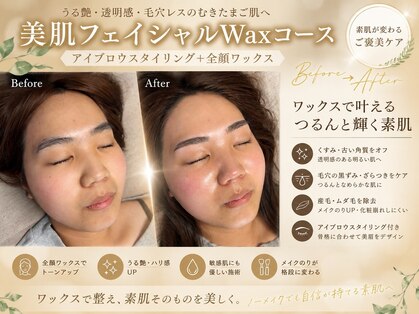 エヌワクシング バイナツ(N-Waxing bynatsu)の写真