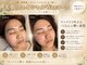 エヌワクシング バイナツ(N-Waxing bynatsu)の写真