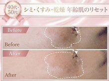 エステサロン エクラ