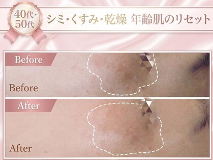 エステサロン エクラの写真
