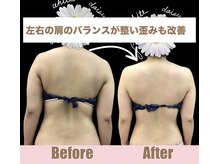 スワン 新栄店(SWAN)/歪んだ骨格はデメリットだらけ