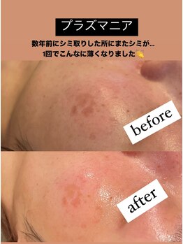 ビューティーネイル(Beauty Nail)/プラズマニア