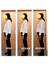 みらい整骨院/産後の姿勢改善と体重減少