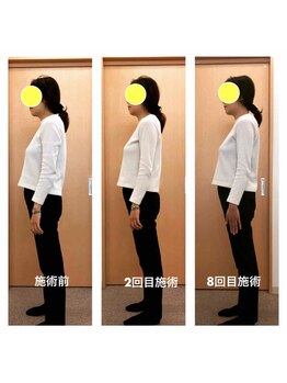 みらい整骨院/産後の姿勢改善と体重減少