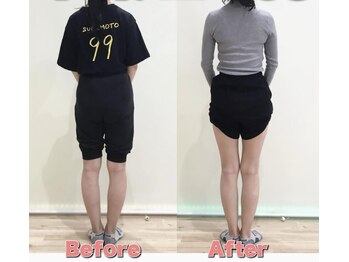 こんだ整骨院/o脚改善ビフォーアフター