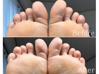 カシェット 広島店(Cachette)/30代女性☆足裏角質ケア60分