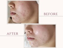 ラインファンタジー 武庫之荘店