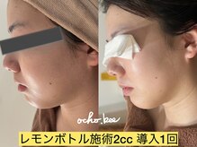 オチョビー(ocho.bee)/レモンボトル導入