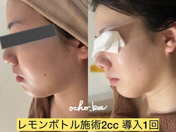 オチョビー(ocho.bee)/レモンボトル導入
