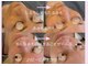 ハピー(HAPPY)の写真