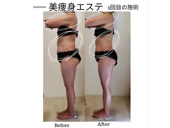 ラエッセス(A Laessess)/